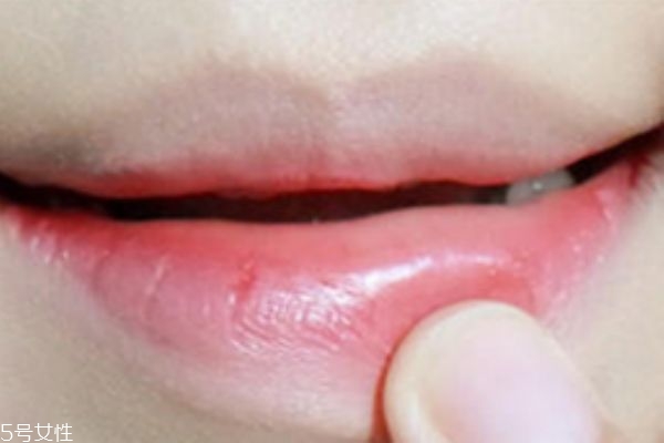 ��ʽҧ��ױ�Ļ��� ������Ůױ��